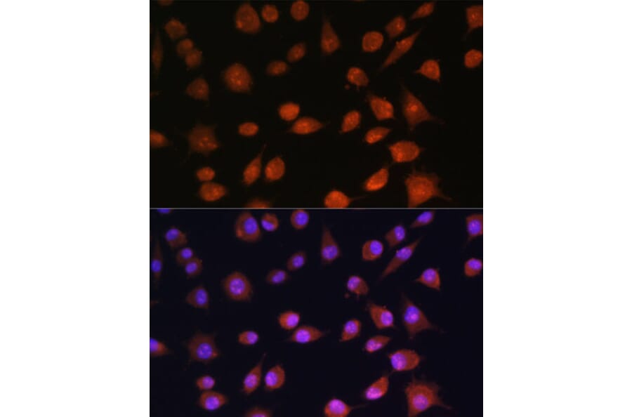 Immunofluorescence - Anti-RPS19BP1/AROS Antibody (A88688) - Antibodies.com