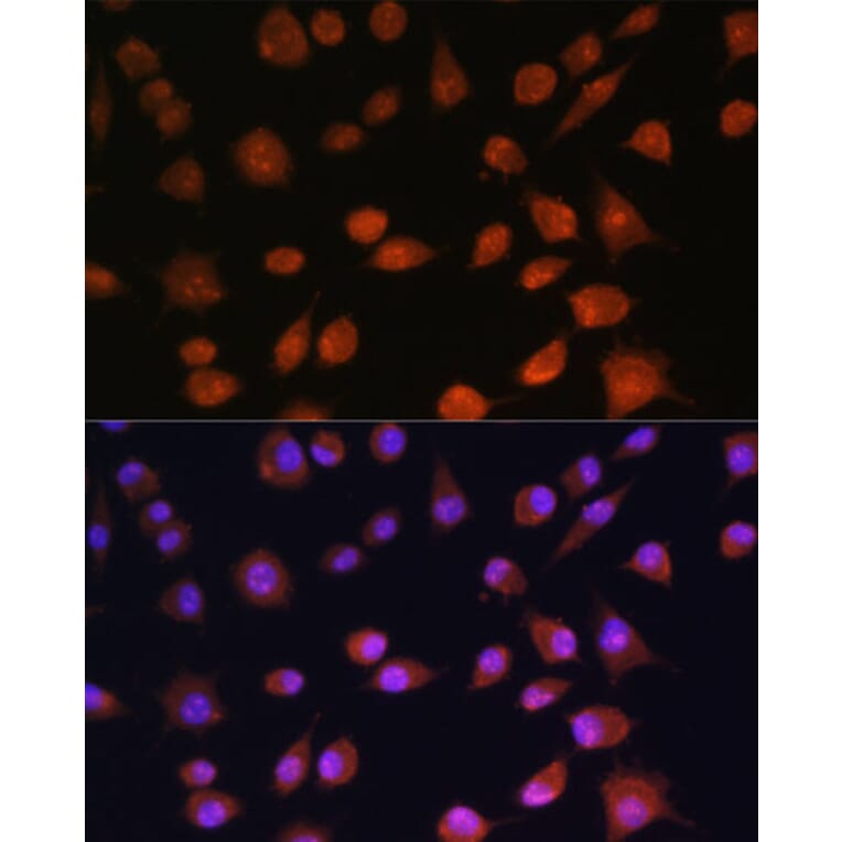 Immunofluorescence - Anti-RPS19BP1/AROS Antibody (A88688) - Antibodies.com