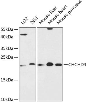 Western blot analysis of extracts of various cell lines, using Anti-CHCHD4 Antibody (A13139) at 1:3000 dilution.
Secondary antibody: Goat Anti-Rabbit IgG (H+L) (HRP) (AS014) at 1:10,000 dilution.
Lysates / proteins: 25µg per lane.
Blocking buffer: 3% non-fat dry milk in TBST.
Detection: ECL Enhanced Kit (RM00021).
Exposure time: 90s.