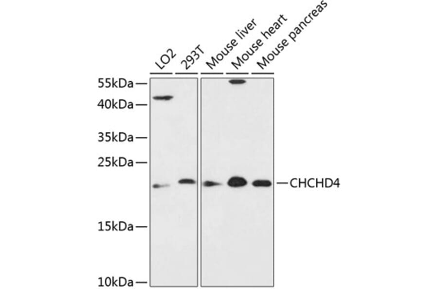 Western Blot - Anti-CHCHD4 Antibody (A88689) - Antibodies.com