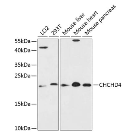 Western Blot - Anti-CHCHD4 Antibody (A88689) - Antibodies.com