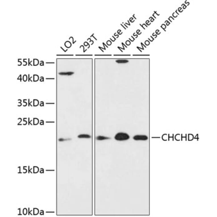 Western Blot - Anti-CHCHD4 Antibody (A88689) - Antibodies.com
