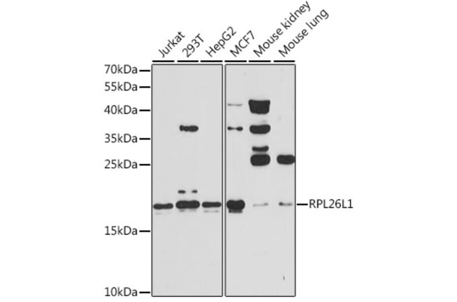 Western Blot - Anti-RPL26L1 Antibody (A14126) - Antibodies.com