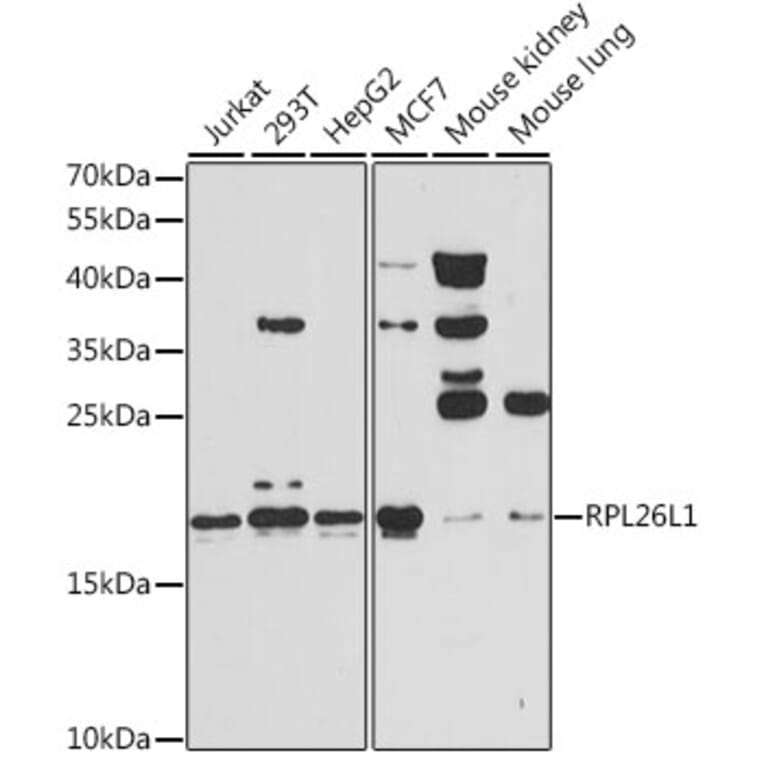 Western Blot - Anti-RPL26L1 Antibody (A14126) - Antibodies.com