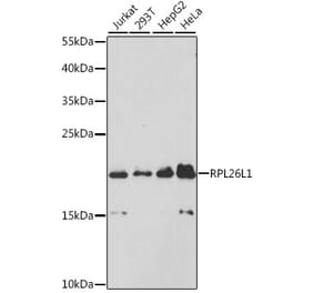 Western Blot - Anti-RPL26L1 Antibody (A88691) - Antibodies.com