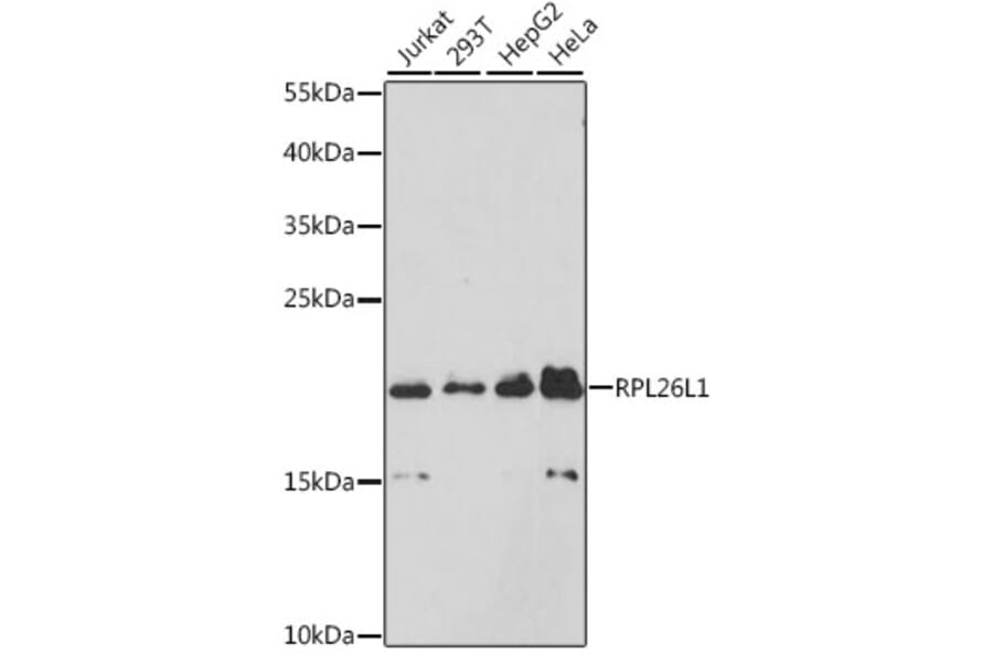 Western Blot - Anti-RPL26L1 Antibody (A88691) - Antibodies.com
