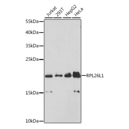 Western Blot - Anti-RPL26L1 Antibody (A88691) - Antibodies.com