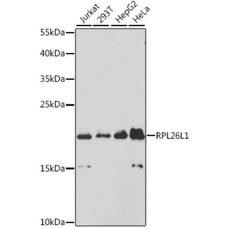 Western Blot - Anti-RPL26L1 Antibody (A88691) - Antibodies.com