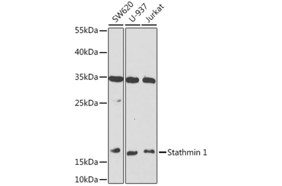 Western Blot - Anti-Stathmin 1 Antibody (A88692) - Antibodies.com