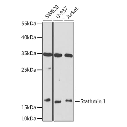 Western Blot - Anti-Stathmin 1 Antibody (A88692) - Antibodies.com