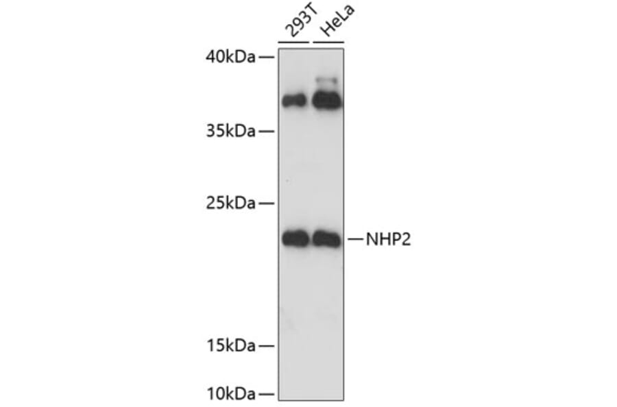 Western Blot - Anti-NHP2 Antibody (A88693) - Antibodies.com