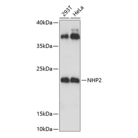 Western Blot - Anti-NHP2 Antibody (A88693) - Antibodies.com