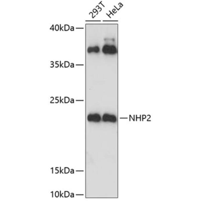 Western Blot - Anti-NHP2 Antibody (A88693) - Antibodies.com