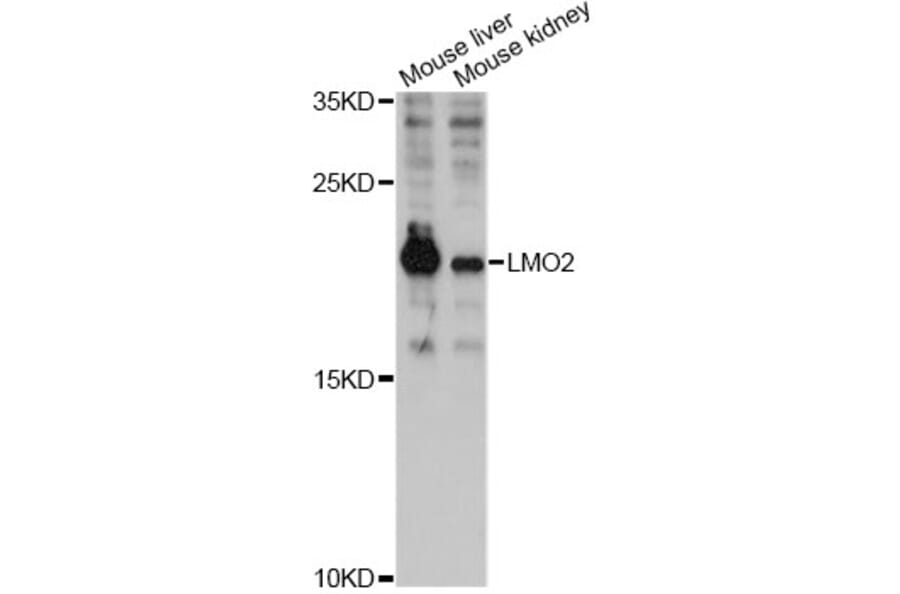 Western Blot - Anti-LMO2 Antibody (A12679) - Antibodies.com