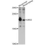 Western Blot - Anti-LMO2 Antibody (A12679) - Antibodies.com