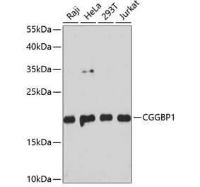 Western Blot - Anti-CGGBP1 Antibody (A88696) - Antibodies.com