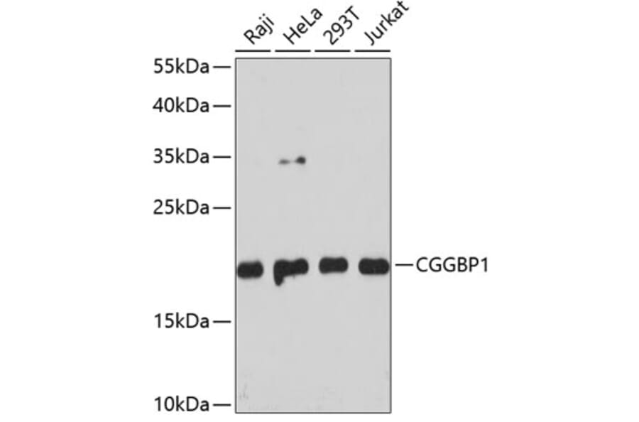 Western Blot - Anti-CGGBP1 Antibody (A88696) - Antibodies.com