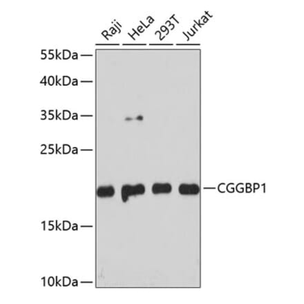 Western Blot - Anti-CGGBP1 Antibody (A88696) - Antibodies.com