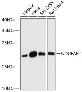 Western blot analysis of extracts of various cell lines, using Anti-NDUFAF2 Antibody (A14296) at 1:3000 dilution.
Secondary antibody: Goat Anti-Rabbit IgG (H+L) (HRP) (AS014) at 1:10,000 dilution.
Lysates / proteins: 25µg per lane.
Blocking buffer: 3% non-fat dry milk in TBST.
Detection: ECL Basic Kit (RM00020).
Exposure time: 90s.