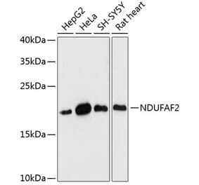 Western Blot - Anti-Mimitin Antibody (A88697) - Antibodies.com