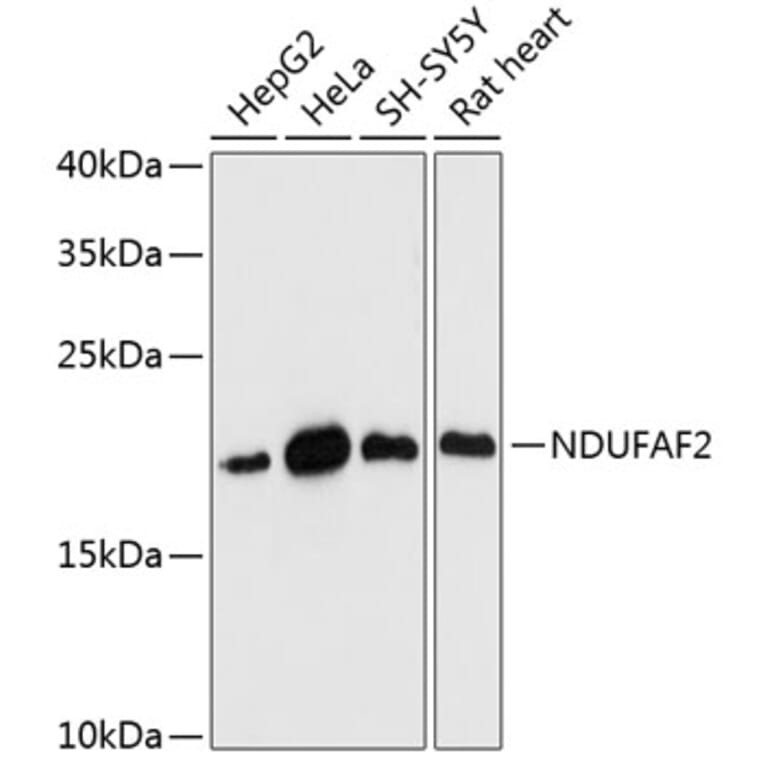 Western Blot - Anti-Mimitin Antibody (A88697) - Antibodies.com
