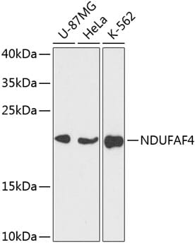 Western blot analysis of extracts of various cell lines, using Anti-NDUFAF4 Antibody (A14345) at 1:3000 dilution.
Secondary antibody: Goat Anti-Rabbit IgG (H+L) (HRP) (AS014) at 1:10,000 dilution.
Lysates / proteins: 25µg per lane.
Blocking buffer: 3% non-fat dry milk in TBST.
Detection: ECL Enhanced Kit (RM00021).
Exposure time: 30s.