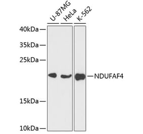 Western Blot - Anti-NDUFAF4 Antibody (A88698) - Antibodies.com