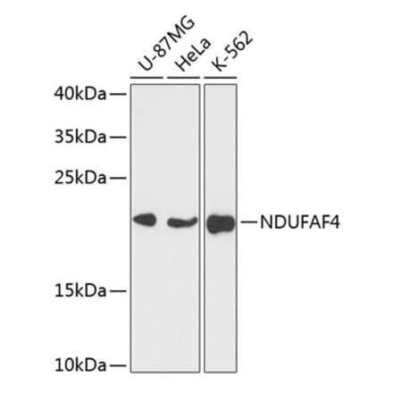 Western Blot - Anti-NDUFAF4 Antibody (A88698) - Antibodies.com