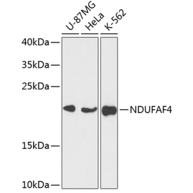 Western Blot - Anti-NDUFAF4 Antibody (A88698) - Antibodies.com