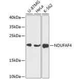 Western Blot - Anti-NDUFAF4 Antibody (A88698) - Antibodies.com