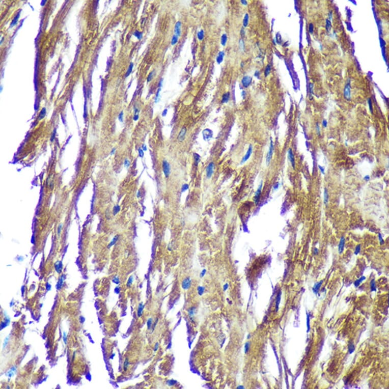 Immunohistochemistry - Anti-NDUFAF4 Antibody (A88698) - Antibodies.com