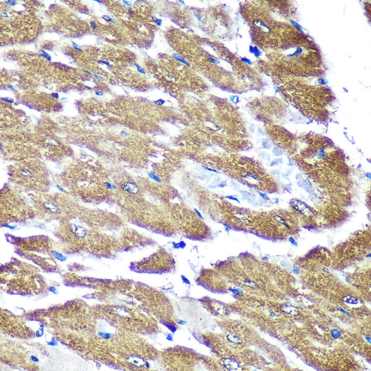 Immunohistochemistry - Anti-NDUFAF4 Antibody (A88698) - Antibodies.com