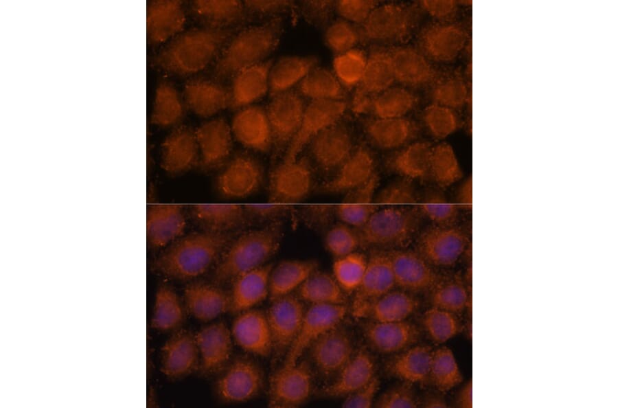 Immunofluorescence - Anti-NDUFAF4 Antibody (A88698) - Antibodies.com