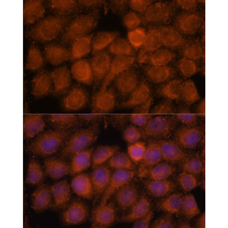 Immunofluorescence - Anti-NDUFAF4 Antibody (A88698) - Antibodies.com