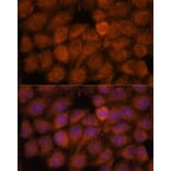 Immunofluorescence - Anti-NDUFAF4 Antibody (A88698) - Antibodies.com