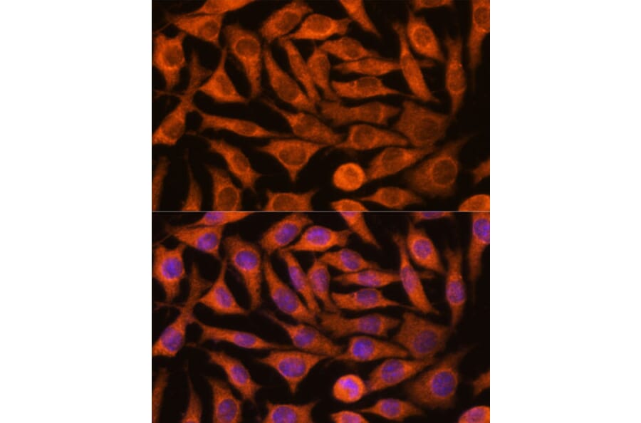 Immunofluorescence - Anti-NDUFAF4 Antibody (A88698) - Antibodies.com