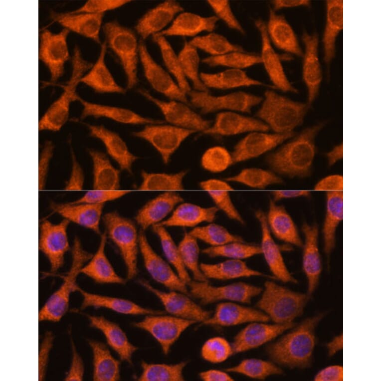 Immunofluorescence - Anti-NDUFAF4 Antibody (A88698) - Antibodies.com