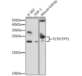 Western Blot - Anti-TCTP Antibody (A88699) - Antibodies.com