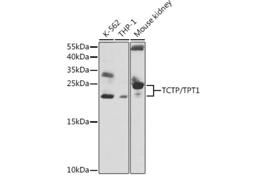 Western Blot - Anti-TCTP Antibody (A88699) - Antibodies.com