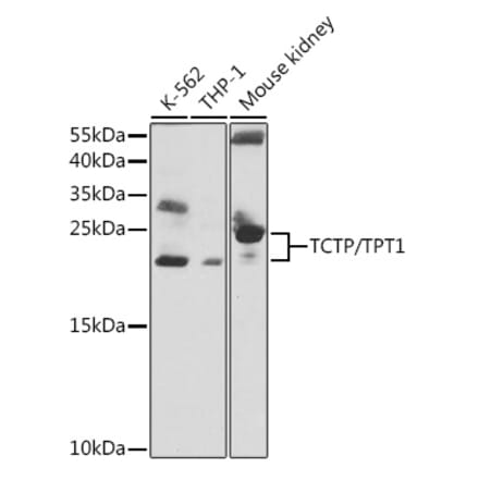 Western Blot - Anti-TCTP Antibody (A88699) - Antibodies.com