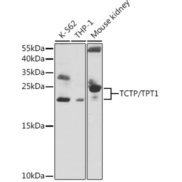 Western Blot - Anti-TCTP Antibody (A88699) - Antibodies.com