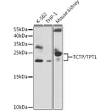Western Blot - Anti-TCTP Antibody (A88699) - Antibodies.com