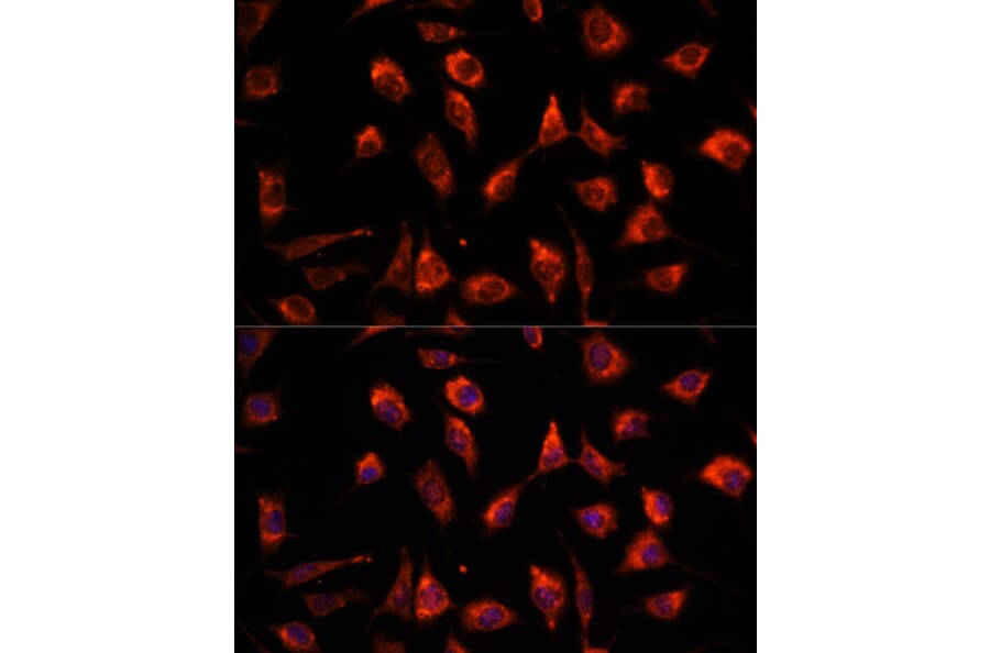 Immunofluorescence - Anti-TCTP Antibody (A88699) - Antibodies.com
