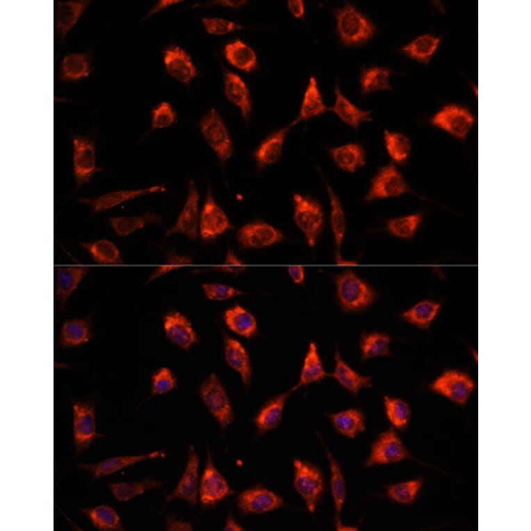 Immunofluorescence - Anti-TCTP Antibody (A88699) - Antibodies.com