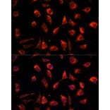 Immunofluorescence - Anti-TCTP Antibody (A88699) - Antibodies.com