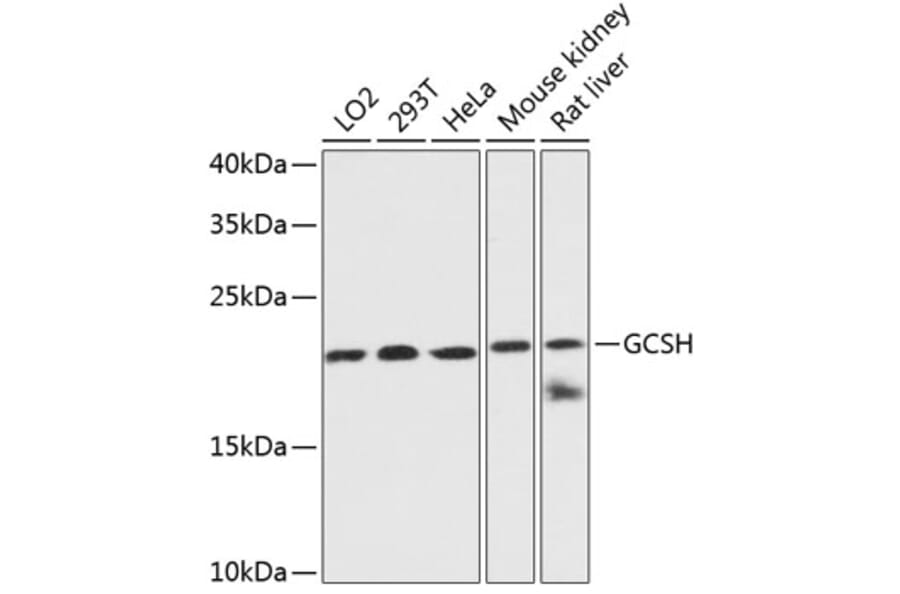 Western Blot - Anti-GCSH Antibody (A88700) - Antibodies.com