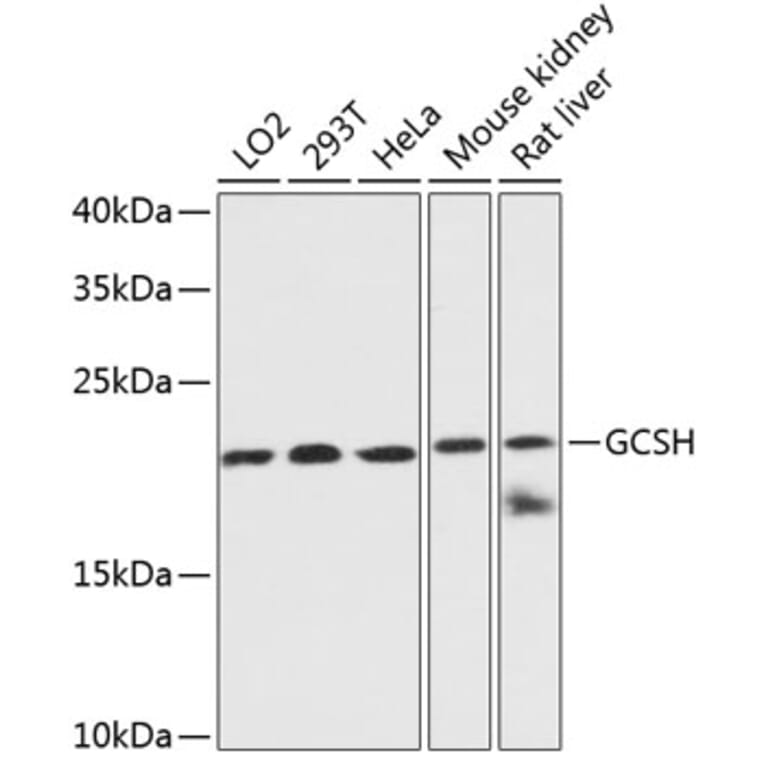 Western Blot - Anti-GCSH Antibody (A88700) - Antibodies.com