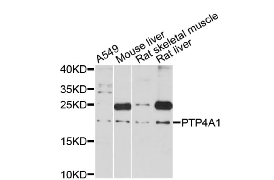 Western Blot - Anti-PTP4A1 Antibody (A12360) - Antibodies.com