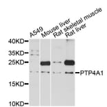 Western Blot - Anti-PTP4A1 Antibody (A12360) - Antibodies.com