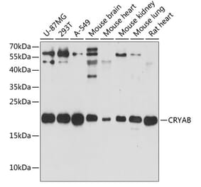 Western Blot - Anti-Alpha B Crystallin Antibody (A88702) - Antibodies.com